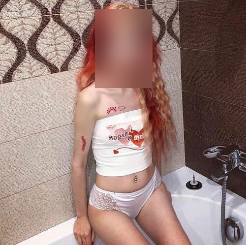 Malina - zdjęcie 2